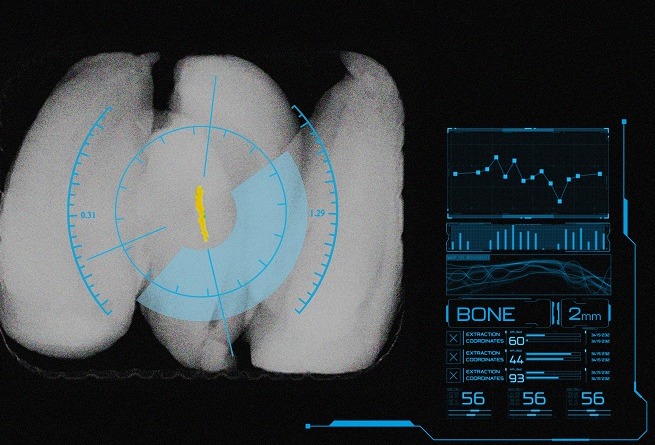 Mettler-Toledo launches X-ray for hard-to-find contaminants