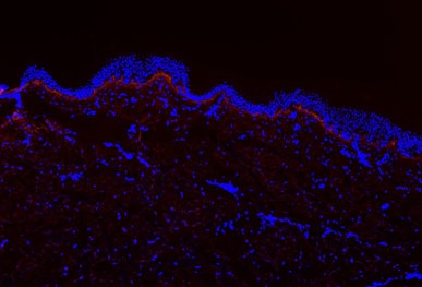New treatment for safe skin cell rejuvenation